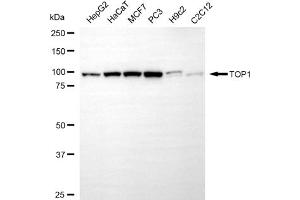 anti-Topoisomerase (DNA) I (TOP1) antibody