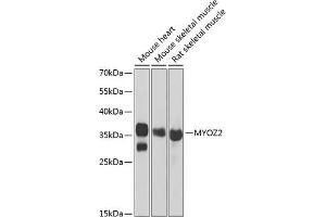 Western blot analysis of extracts of various cell lines, using MYOZ2 antibody (ABIN6129772, ABIN6144299, ABIN6144300 and ABIN6222126) at 1:1000 dilution. (MYOZ2 抗体  (AA 1-264))