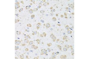 Immunohistochemistry (IHC) image for anti-Albumin (ALB) (AA 20-255) antibody (ABIN3020954)