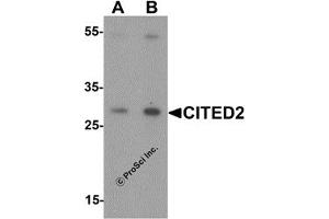 Western Blotting (WB) image for anti-Cbp/p300-Interacting Transactivator, with Glu/Asp-Rich Carboxy-terminal Domain, 2 (CITED2) (N-Term) antibody (ABIN1077387) (CITED2 抗体  (N-Term))