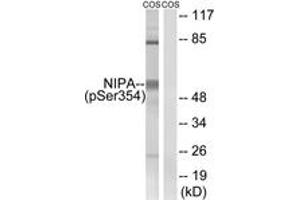 Western blot analysis of extracts from COS7 cells treated with HU 2nM 24h, using NIPA (Phospho-Ser354) Antibody. (ZC3HC1 抗体  (pSer354))