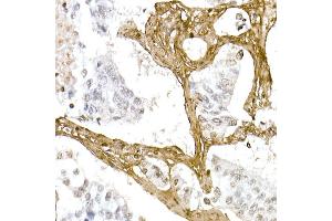 Immunohistochemistry (IHC) image for anti-Collagen, Type I, alpha 1 (COL1A1) (AA 100-200) antibody (ABIN6138837)