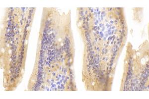 Detection of RBP2 in Mouse Small intestine Tissue using Polyclonal Antibody to Retinol Binding Protein 2, Cellular (RBP2) (RBP2 抗体  (AA 1-134))