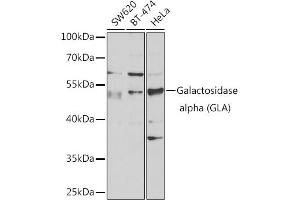 Western blot analysis of extracts of various cell lines, using Galactosidase alpha (Galactosidase alpha (GLA)) antibody (ABIN6131511, ABIN6141114, ABIN6141116 and ABIN6218799) at 1:1000 dilution. (GLA 抗体  (AA 150-429))