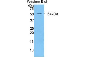 Western blot analysis of the recombinant protein. (WNT10A 抗体  (AA 108-343))