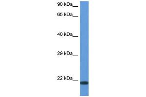 WB Suggested Anti-CD70 AntibodyTitration: 1.