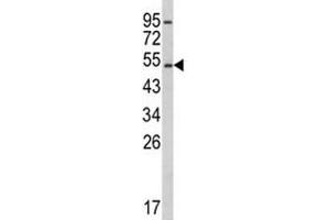 Western Blotting (WB) image for anti-Cytochrome P450, Family 2, Subfamily E, Polypeptide 1 (CYP2E1) (AA 402-429) antibody (ABIN3030687)
