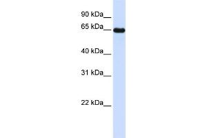 WB Suggested Anti-LMOD1 Antibody Titration: 0. (Leiomodin 1 抗体  (N-Term))