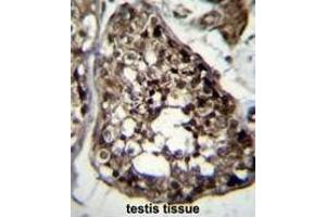 TBCEL Antibody (C-term) immunohistochemistry analysis in formalin fixed and paraffin embedded human testis tissue followed by peroxidase conjugation of the secondary antibody and DAB staining. (TBCEL 抗体  (C-Term))