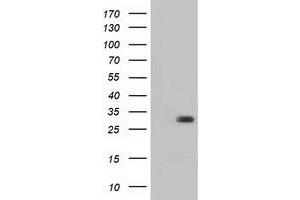 Image no. 1 for anti-3-hydroxybutyrate Dehydrogenase, Type 2 (BDH2) antibody (ABIN1496857) (BDH2 抗体)