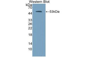 Western blot analysis of the recombinant protein. (Thrombospondin 2 抗体  (AA 968-1170))
