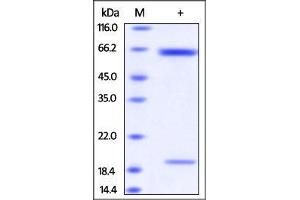 SDS-PAGE (SDS) image for Proprotein Convertase Subtilisin/kexin Type 9 (PCSK9) (AA 31-691) (Active) protein (His tag) (ABIN2181592)