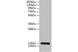 Western blot All lanes: CDA antibody at 2 μg/mL + 293T whole cell lysate Secondary Goat polyclonal to rabbit IgG at 1/10000 dilution Predicted band size: 17 kDa Observed band size: 17 kDa (CDA 抗体  (AA 1-146))