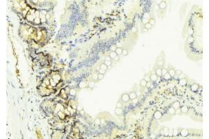 ABIN6274654 at 1/100 staining Mouse colon tissue by IHC-P. (CYP2W1 抗体  (Internal Region))