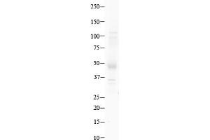 Host:  Rabbit  Target Name:  GSH2  Sample Type:  Human Testis   Antibody Dilution:  1. (GSX2 抗体  (N-Term))