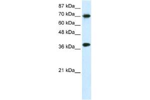 WB Suggested Anti-TCEA1 Antibody Titration:  0. (TCEA1 抗体  (N-Term))