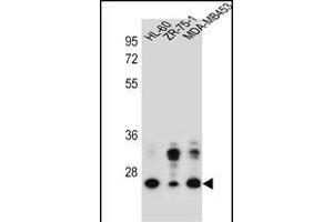 GFRA4 Antibody (Center) (ABIN657173 and ABIN2837905) western blot analysis in HL-60,ZR-75-1,MDA-M cell line lysates (35 μg/lane). (GFRA4 抗体  (AA 156-184))