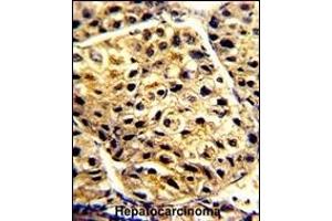Immunohistochemistry (Paraffin-embedded Sections) (IHC (p)) image for anti-Arylacetamide Deacetylase (Esterase) (AADAC) (AA 273-300), (C-Term) antibody (ABIN390780)