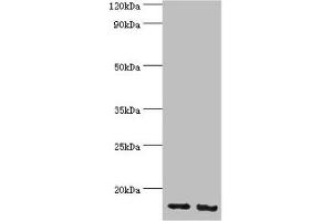 Western blot All lanes: E3 ubiquitin-protein ligase RBX1 antibody at 4 μg/mL Lane 1: Hela whole cell lysate Lane 2: HepG2 whole cell lysate Secondary Goat polyclonal to rabbit IgG at 1/10000 dilution Predicted band size: 12 kDa Observed band size: 12 kDa (RBX1 抗体  (AA 1-108))