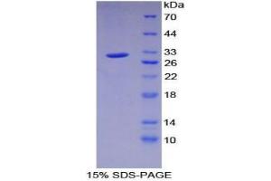 SDS-PAGE analysis of Human PRKAg1 Protein. (PRKAG1 蛋白)