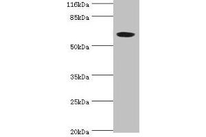 Western blot All lanes: SLC13A4 antibody at 2 μg/mL + 293T whole cell lysate Secondary Goat polyclonal to rabbit IgG at 1/10000 dilution Predicted band size: 69 kDa Observed band size: 69 kDa