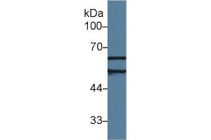 Western Blot; Sample: Human Jurkat cell lysate; Primary Ab: 1µg/ml Rabbit Anti-Rat AchE Antibody Second Ab: 0. (Acetylcholinesterase 抗体  (AA 157-332))