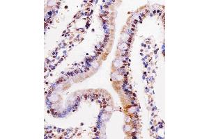 Immunohistochemical analysis of paraffin-embedded rat small intestine section using Rat Cdk4 Antibody (C-term) B. (CDK4 抗体  (C-Term))