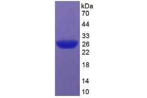 SDS-PAGE analysis of Rat Caspase 9 Protein. (Caspase 9 蛋白)