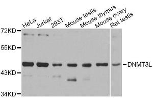 Western blot analysis of extracts of various cell lines, using DNMT3L antibody. (DNMT3L 抗体  (AA 151-386))