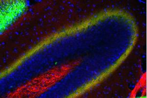 Immunostaining of a PFA fixed mouse hippocampus section with anti-Doc2a/b (dilution 1 : 200; red) and Oyster® 650 labeled anti-calretinin (cat. (Doc 2a/b (AA 1-403) 抗体)