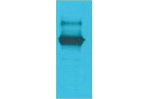 Western Blotting (WB) image for anti-LexA DNA Binding Region antibody (ABIN3181558) (LexA DNA Binding Region 抗体)