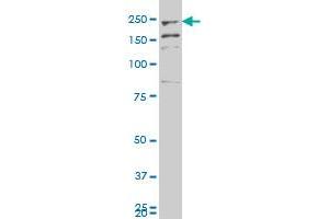 FER1L3 polyclonal antibody (A01), Lot # 060529JCS1. (Myoferlin 抗体  (AA 655-754))