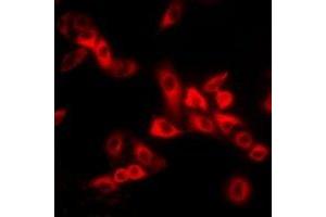 Immunofluorescent analysis of MYL2 staining in MCF7 cells. (MYL2 抗体)
