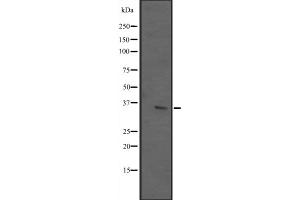Western blot analysis of ING2 expression in T47-D cell lysate,The lane on the left is treated with the antigen-specific peptide. (ING2 抗体  (C-Term))