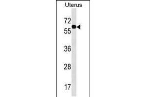Western blot analysis in Uterus tissue lysates (35ug/lane). (Phosphoglucomutase 3 抗体  (AA 237-263))
