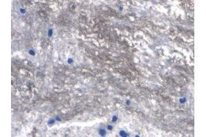 IHC-P analysis of Rat Spinal cord Tissue, with DAB staining. (RANKL 抗体  (AA 106-240))