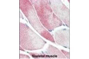Formalin-fixed and paraffin-embedded human Skeletal Muscle tissue reacted with JMJD3 Antibody (C-term) (ABIN387863 and ABIN2844040) , which was peroxidase-conjugated to the secondary antibody, followed by AEC staining. (Kdm6b 抗体  (C-Term))