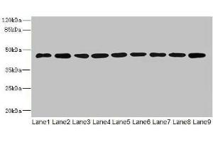 Western blot All lanes: SH3GLB2 antibody at 1 μg/mL Lane 1: Hela whole cell lysate Lane 2: Mouse gonadal tissue Lane 3: Mouse lung tissue Lane 4: U87 whole cell lysate Lane 5: THP-1 whole cell lysate Lane 6: A549 whole cell lysate Lane 7: MCF-7 whole cell lysate Lane 8: Mouse liver tissue Lane 9: A431 whole cell lysate Secondary Goat polyclonal to rabbit IgG at 1/10000 dilution Predicted band size: 44, 45 kDa Observed band size: 44 kDa (SH3GLB2 抗体  (AA 1-395))