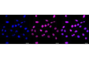 Immunocytochemical staining of HepG2 cells with Nucleoporin 50 antibody (ABIN7799678), 1:1,000).