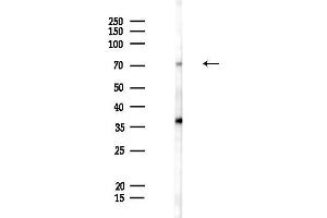Western blot analysis of lysates from HepG2 cells(LPS,4h treatment), using PRDM8 Antibody at 1/1000 dilution.
