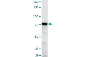 ADD3 polyclonal antibody (A01), Lot # CHI0060725QCS1. (ADD3 抗体  (AA 462-560))