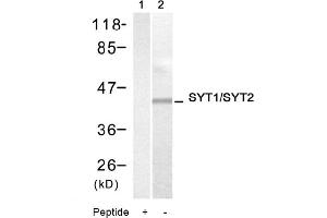 Image no. 1 for anti-Synaptotagmin I (SYT1) (Thr199), (Thr202) antibody (ABIN319342) (SYT1 抗体  (Thr199, Thr202))