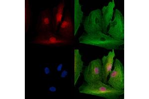 ABIN7094778 and ABIN7098829 staining  cells by IF/ICC. (SSRP1 抗体  (Internal Region))