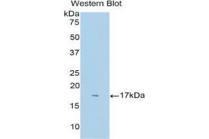 Western blot analysis of the recombinant protein. (Neuropilin 1 抗体  (AA 27-141))