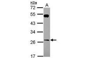 Image no. 1 for anti-RAB26, Member RAS Oncogene Family (RAB26) (AA 53-238) antibody (ABIN1500556) (RAB26 抗体  (AA 53-238))