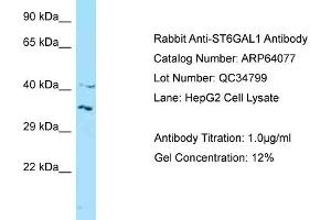 Western Blotting (WB) image for anti-ST6 beta-Galactosamide alpha-2,6-Sialyltranferase 1 (ST6GAL1) (N-Term) antibody (ABIN971799) (ST6GAL1 抗体  (N-Term))