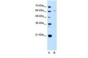 Image no. 1 for anti-Chromatin Licensing and DNA Replication Factor 1 (CDT1) (AA 400-449) antibody (ABIN6739459) (CDT1 抗体  (AA 400-449))