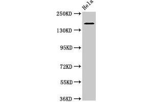 Western Blot Positive WB detected in: Hela whole cell lysate All lanes: ROBO1 antibody at 3. (ROBO1 抗体  (AA 29-143))