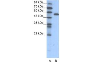 Western Blotting (WB) image for anti-Forkhead Box C2 (MFH-1, Mesenchyme Forkhead 1) (FOXC2) antibody (ABIN2460278) (FOXC2 抗体)