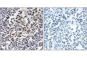 Immunohistochemistry analysis of paraffin-embedded human lymph node tissue, using PGLS Antibody. (PGLS 抗体  (AA 191-240))